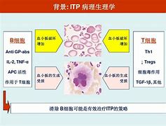 TGB医学是什么意思_gbm医学上是什么意思